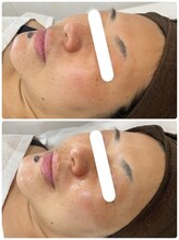 ムー(mu)/ララピール/市川/妙典/浦安