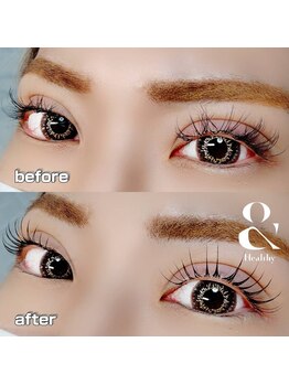 アイズ クリーム(Eyes Cream)/&Healthy/アンドヘルシー/エクパ