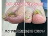 トラブルフットネイル　分厚くなって切れない足の爪ケア★foot bath付　¥4500