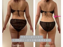 ヨサパーク エミリア(YOSA PARK Emiria)/ダイエットコースのお客様