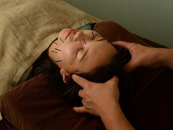 シーン(SHINE)の写真/《年齢肌に悩む方必見》美容鍼でむくみ/たるみを改善し小顔へ導きます◎ほうれい線・目のクマを集中ケア！
