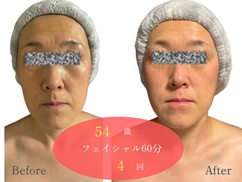 アルピナ(ALPINA)/ウルトランスフォーマー