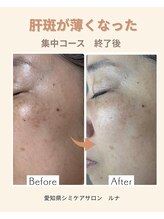 サロンルナ(Salon Luna)/50代　６回目