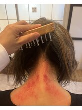 さとみ整体院/カッサ後