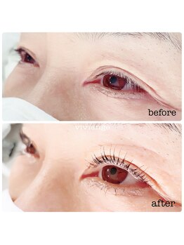 ヴィヴィアンジュ(viviange)/ラッシュリフト