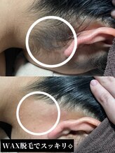 ウィズティ(with.T)/Wax脱毛