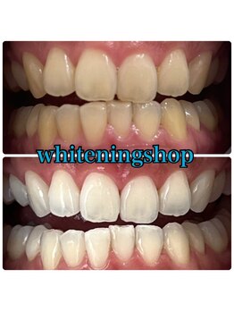 ホワイトニングショップ 倉敷店/