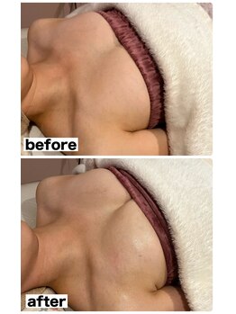 マイントゥー(mine too)/