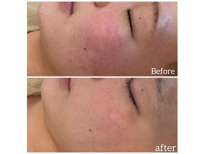 ウィルビューティーサロン(will beauty salon)の写真
