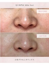 ミルフィオリ(Mille fiori)/白雪プラセンタワックス