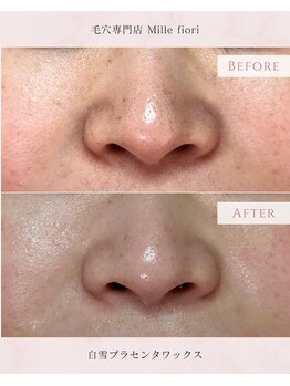 ミルフィオリ(Mille fiori)/白雪プラセンタワックス