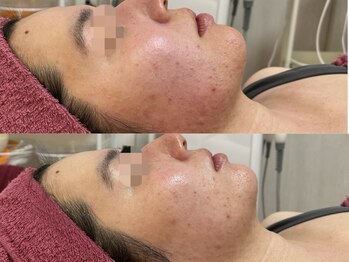 GRACETHOUSAND(グレイスサウザンド)/アンストレス/乾燥/赤み改善