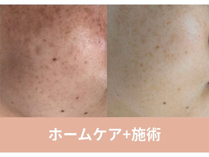 マインドールの写真