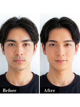 ウィンサムテン 新宿店(Winsome)の写真/初めてのメンズひげ脱毛もおすすめ！最小限の痛みで高い効果実感☆コスパ・タイパを重視したい方に◎新宿駅