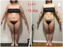 オージャス(OJAS)/40代○○様の変化　痩ボディーへ