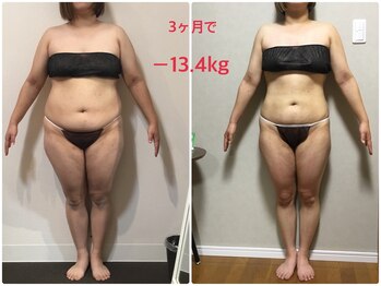オージャス(OJAS)/40代○○様の変化　痩ボディーへ