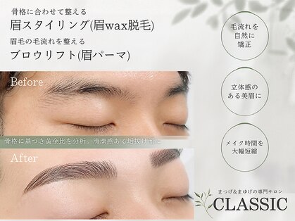 クラシック(CLASSIC)の写真