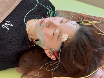 鍼灸サロンライフ(LIFE)の写真/【肌荒れにお悩みの方へ】内側からアプローチする本格ケアで、トラブルに負けない健やかな素肌へ導きます◎