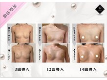 エデンノーヴァ バイ ザ オリエンタトウキョウ(EDEN NOVA by The Orienta Tokyo)の雰囲気（【DT無し！脂肪そのものを増やしていく】人気No.1メニュー★）