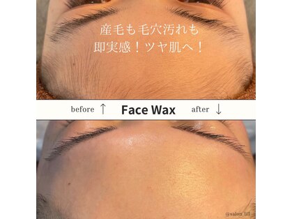 リル(Lill)の写真