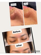 トータルビューティージュネス(TOTAL BEAUTY JEUNESSE)/眉ＷＡＸ脱毛＋毛穴洗浄FA