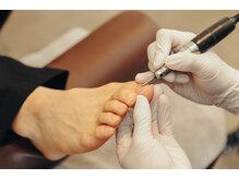 トラスト整体院 袋井院/巻き爪、陥入爪