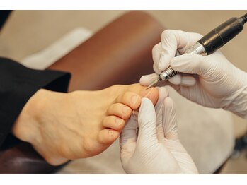 トラスト整体院 袋井院/巻き爪、陥入爪