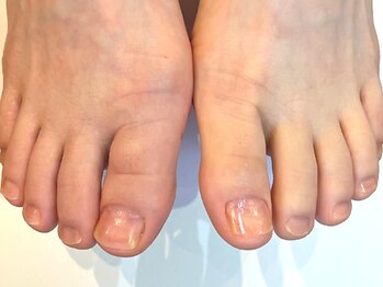 クオーレ(Cuore)の写真/【フットケア専門店】足爪の環境改善◎セルフケアが難しい部分は〈爪の美容院 Cuore〉にお任せください♪