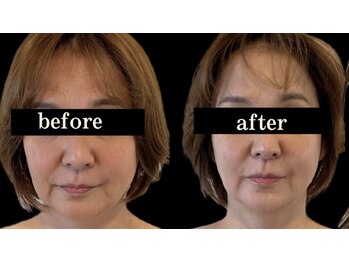 ソナ 大和西大寺院(SONA)/