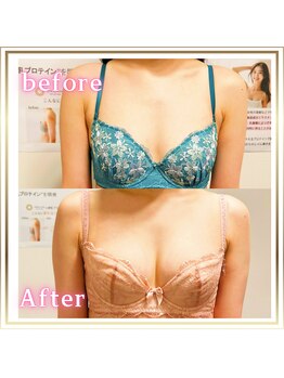 ジュエルリング(Jewel Ring)/バストアップ恵比寿・渋谷