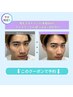 《再来/学割U24/人気No3》美眉WAX+毛量調整(間引き/カット)×選択フェイスWAX