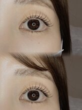 アニュレア バイ レヴィエリス(Anurea by Re’VIELISS)