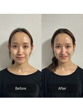 プラスアルファ(PLUSALPHA)/【驚きの艶小顔】