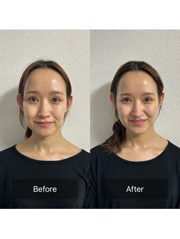 プラスアルファ(PLUSALPHA)/【驚きの艶小顔】