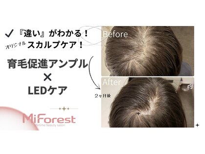 Mi Forestの写真