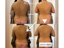 マカロン(Macaron)の雰囲気（美容機器で確かな改善。誰よりも綺麗でいてほしいから。#痩身）