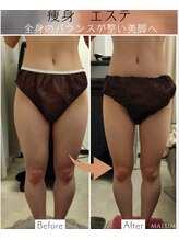 マールム(MALUM)/下半身集中痩身