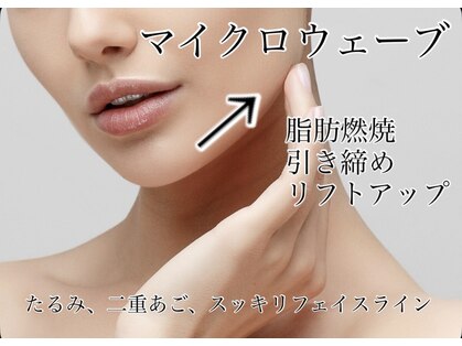 グラッソ(GRASSO)の写真