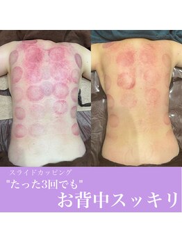 フリグス(Frigus)/【スライドカッピング】