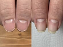 アルヴィス(Arviss)/自爪育成