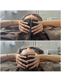 モア(moa)/小顔×頭蓋調整