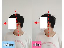 エンビジョン(ENVISION)/before→after