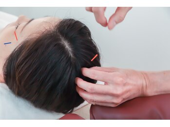 美容鍼灸salonまつもと/