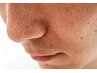 【都度払いお得なセット1】忙しい方へ！毛穴洗浄とヒゲ脱毛を一緒に！50分