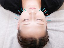 ネイビー鍼灸指圧治療院(NAVY鍼灸指圧治療院)/NAVV式　美容鍼