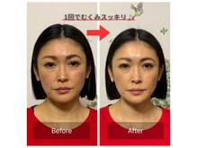 ハリカフェ(HARI CAFE)の雰囲気（施術後の変化に感動される方が、たくさんいらっしゃいます）