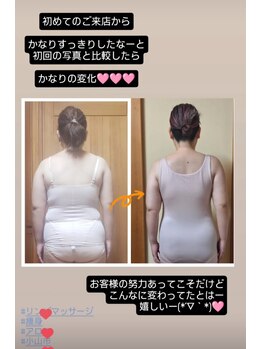 ステラ(Stella)/【痩身】ボディリンパマッサージ