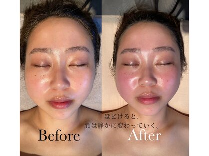 イニ(1n1)の写真