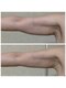痩身 脱毛専門サロン 椿の写真/二の腕ケアはプロにお任せ!脂肪冷却で自分ではできない理想の細い二の腕に★