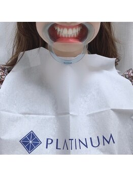 ライトビューティー 錦糸町店(lightbeauty)/かんたんホワイトニングの手順３